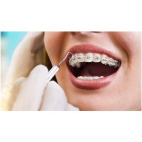 Enjuague Bucal Vitis Orthodontic 500 ml - Imagen 3